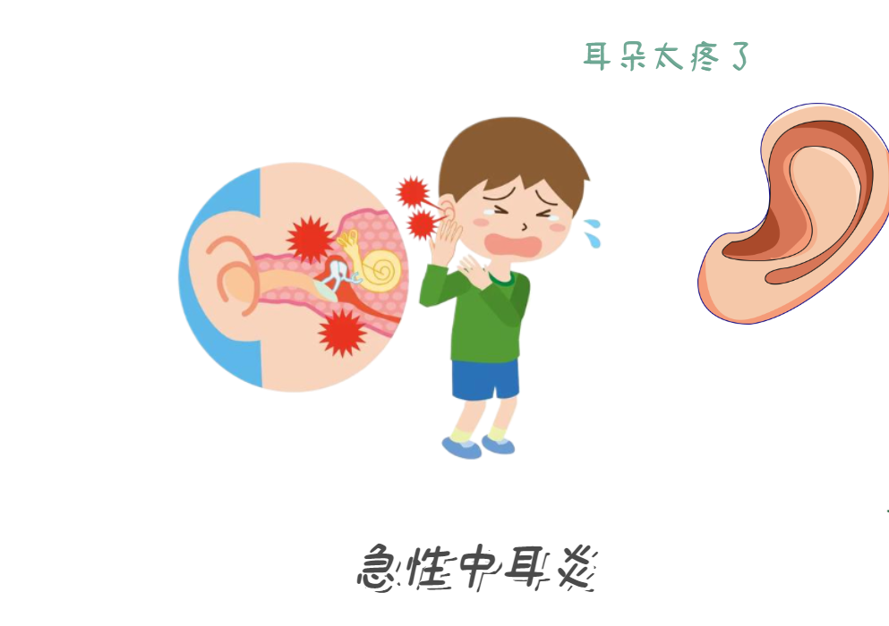 急性中耳炎.png