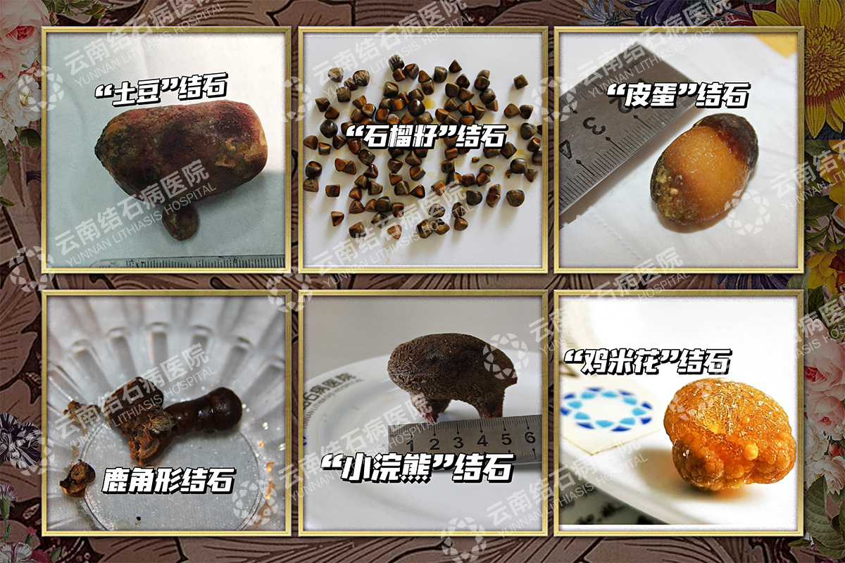 微信图片_20220305111214-sy.jpg