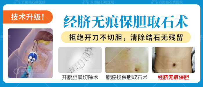 20250815经脐保胆-文章-02.jpg