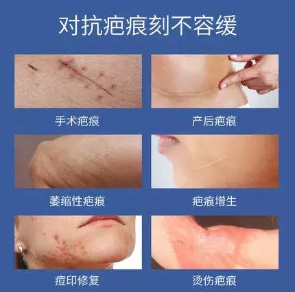 丽合疤痕修复 让美丽重获新生