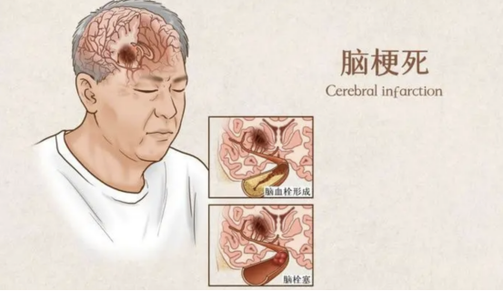 1701339616676351.png image.png